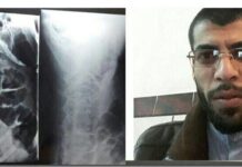 Ahmad Kaabi, an exiled political prisoner in Kerman Prison